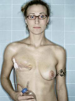 Kerry Mansfield, Self-Portrait, Post Mastectomy, 2005. Image courtesy of the artist.